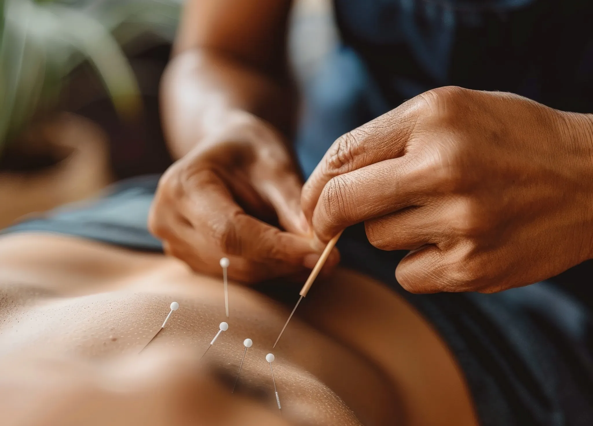Acupuncturist